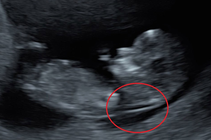 sonography NT - farjadgroup