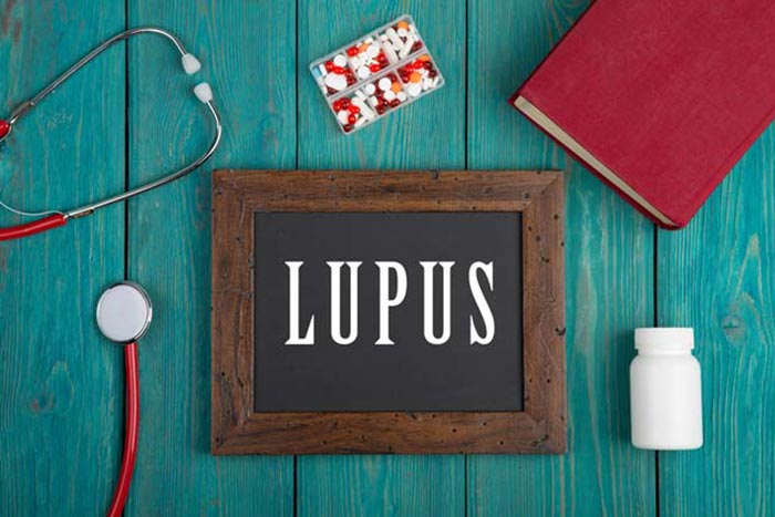 بیماری لوپوس - صفر تا صد بیماری لوپوس - لوپوس - گروه تشخیصی درمانی فرجاد - فرجاد قم - فرجاد - درمان بیماری لوپوس - علائم بیماری لوپوس